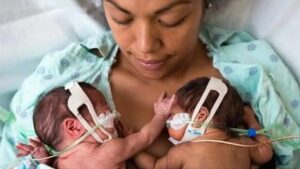 Read more about the article WORLD PREMATURITY DAY